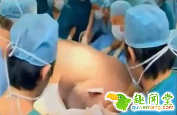 一胎生了11个娃，十几个医生接生，直接生了个足球队！