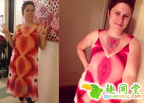 不是你看错，大家都觉得她的这件衣服像××