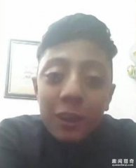 吓呆！14岁少年能将眼球弹出10毫米