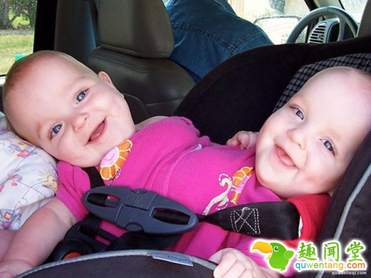 世界最罕见的连体婴，长大分开后的人生是这样