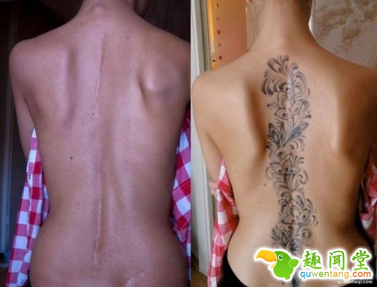 纹身拯救伤疤，甚至还能还你一只“眼睛”！