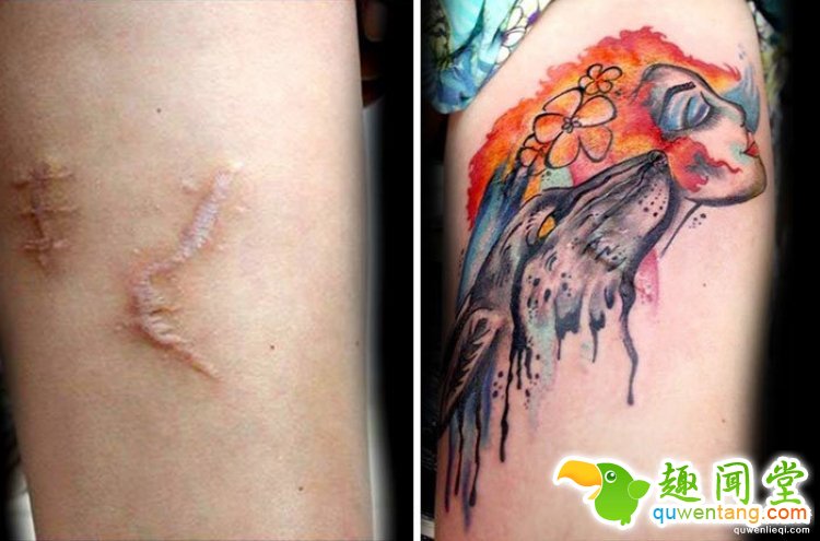 纹身拯救伤疤，甚至还能还你一只“眼睛”！