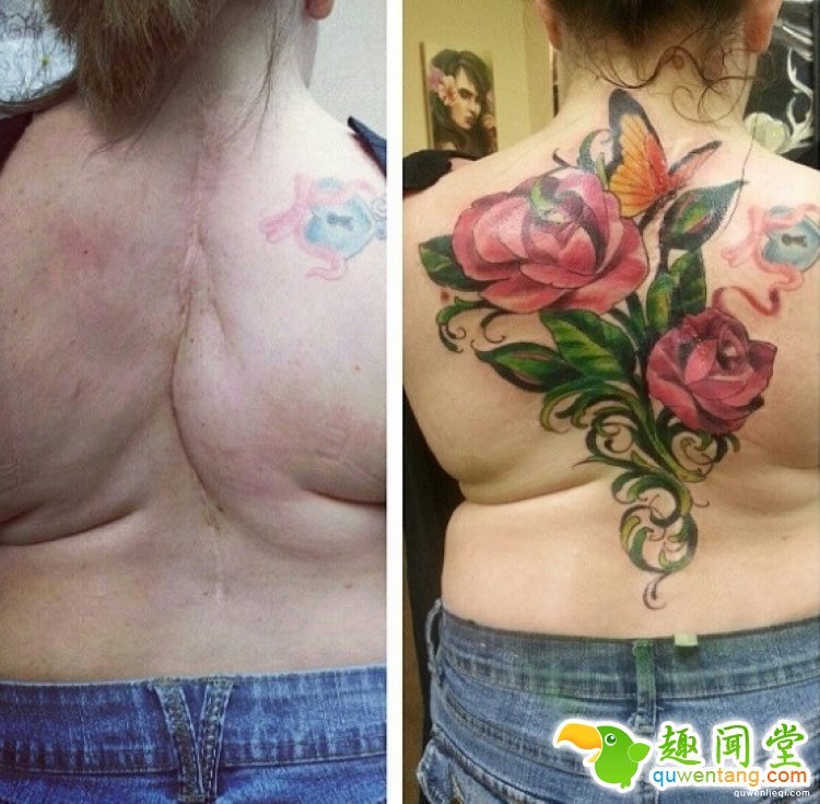 纹身拯救伤疤，甚至还能还你一只“眼睛”！