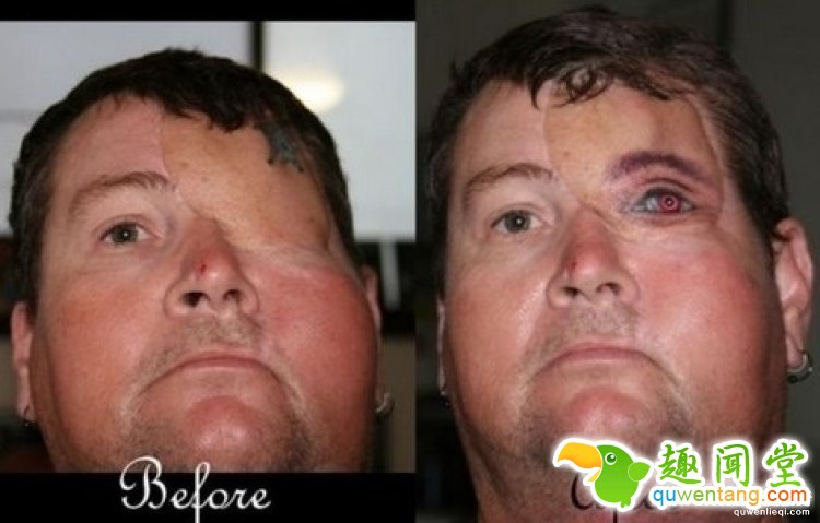 纹身拯救伤疤，甚至还能还你一只“眼睛”！