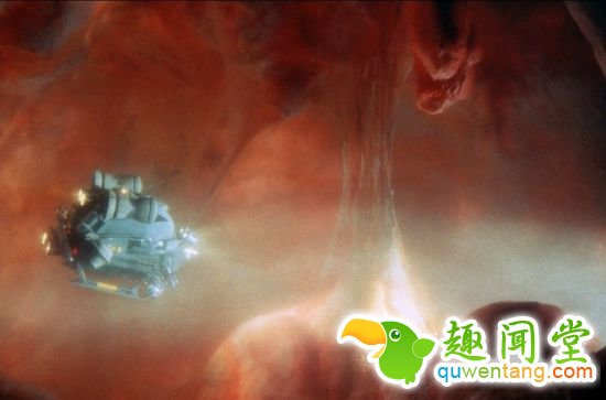 不慎吞下异物怎么办？那再吞一个机器人吧