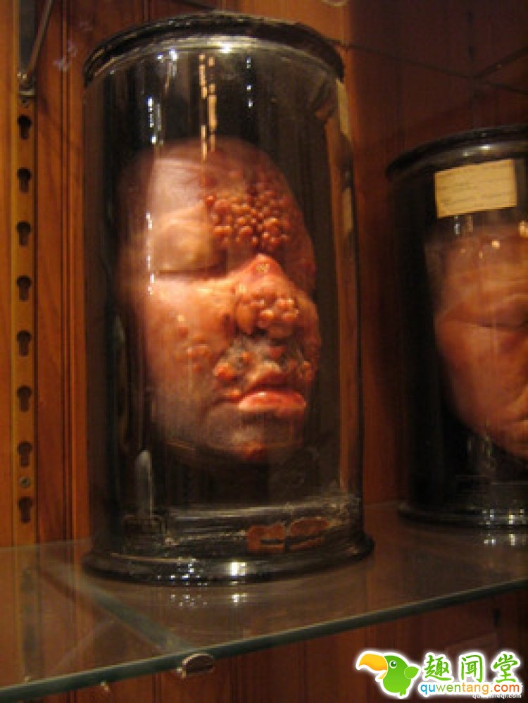 【深夜毒物】相信我，这家藏有奇异人体的博物馆你不会想进去的