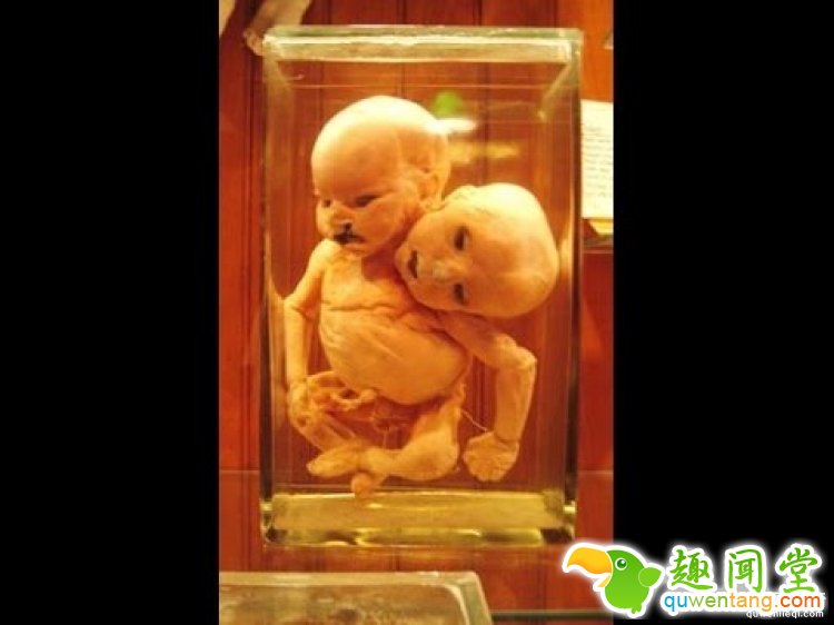 【深夜毒物】相信我，这家藏有奇异人体的博物馆你不会想进去的