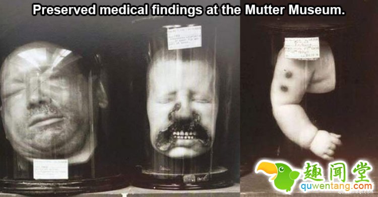 【深夜毒物】相信我，这家藏有奇异人体的博物馆你不会想进去的