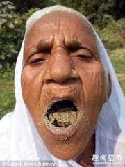 吃沙成瘾，78岁老太从15岁开始吃沙子，一