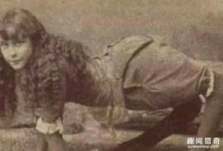 惊！她貌美女花却先天膝盖畸形，只能四肢