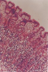 9大比你想的要年轻的身体关键部分