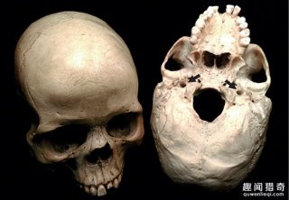 惊讶！300万年人类脑洞大6倍
