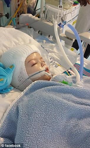 连体婴儿奇迹般存活！24小时的手术没有压倒美国这对双胞胎