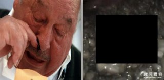 超恶心！老大爷鼻子流鼻血不止还飞出虫子