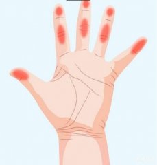 7种手痛代表身体已经在发出健康警讯，如